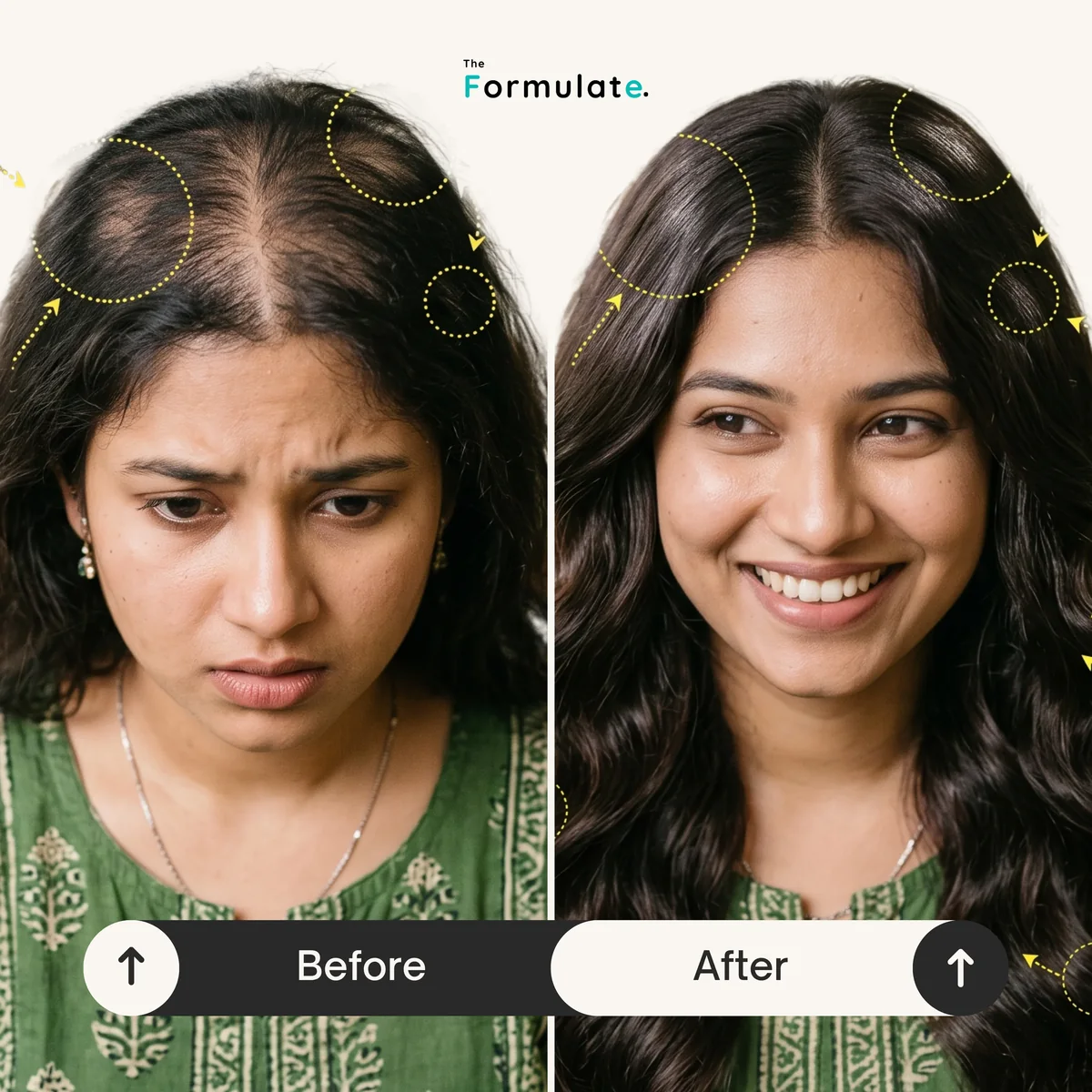 Rosemary Hair Serum ব্যবহারের আগে ও পরে চুলের ঘনত্বের পার্থক্য